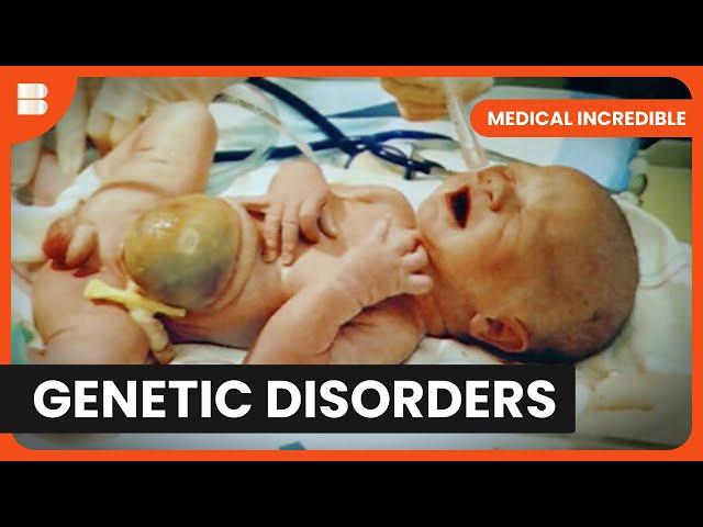Defying Odds: Baby's Survival Story - Medical Incredible - Documentary