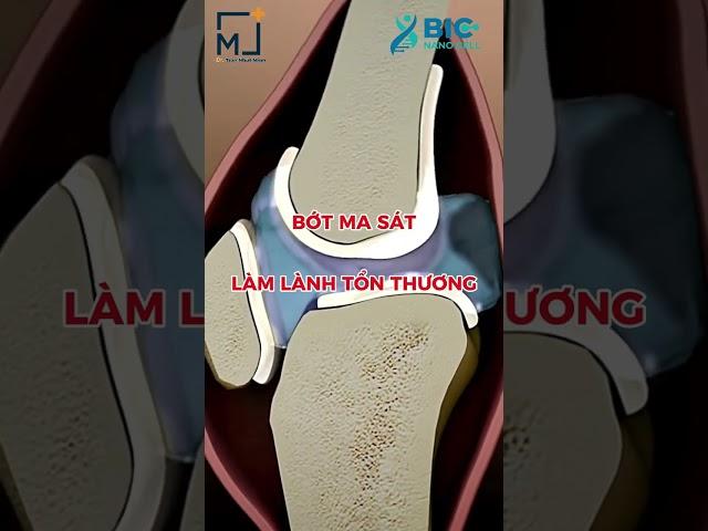 BẬT MÍ PHƯƠNG PHÁP ĐIỀU TRỊ THOÁI HÓA KHỚP GỐI HIỆU QUẢ | BÁC SĨ TRẦN MINH
