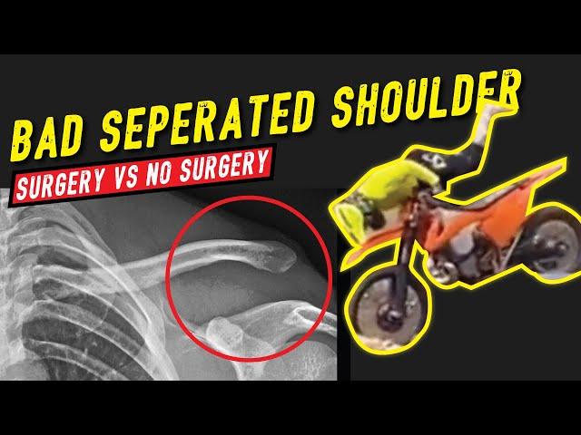 Enduro Crash Separated Shoulder Grade 5: Surgery vs No Surgery