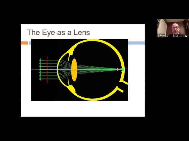 Pushing the Limits in the Surgical Correction of Keratoconus - Dr. Guillermo Rocha