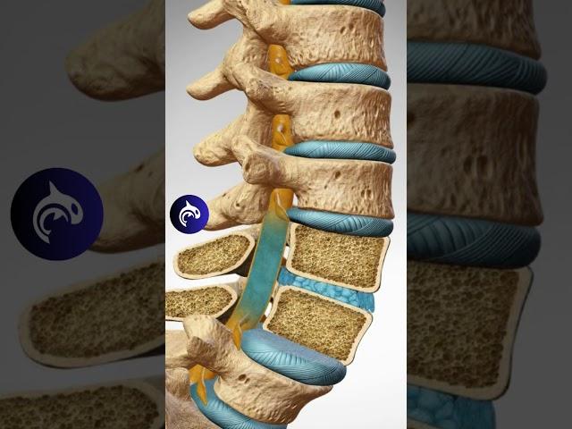 See how Spondylolisthesis affects the Spine in 3D Animation