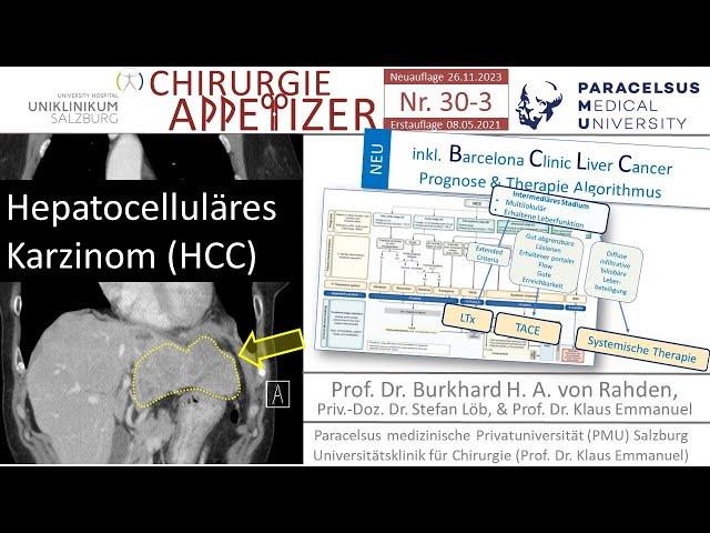 Hepatozelluläres Karzinom (HCC) CHIRURGIE APPetizer Nr. 30-3