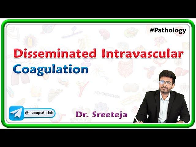 12. Disseminated Intravascular Coagulation (DIC) | USMLE Step 1 Pathology