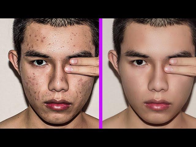 Fastest way to clean your face in photoshop | Remove pimples, blemishes, acne easily