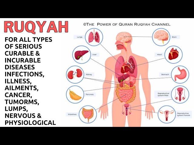 Ruqyah for all Types of Serious Curable&Incurable Diseases,Infections, Illness,Cancer,Tumorms&Lumps