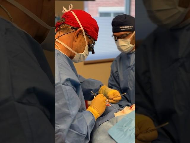 Witness this insane rhinoplasty and septoplasty transformation! 