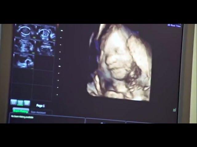 3D or 4D Scan (26 Weeks - 32 Weeks)