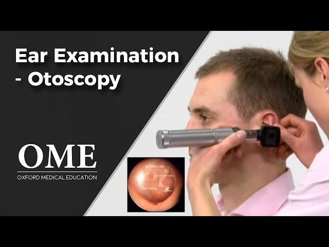 Otoscopy (Ear Examination) - ENT