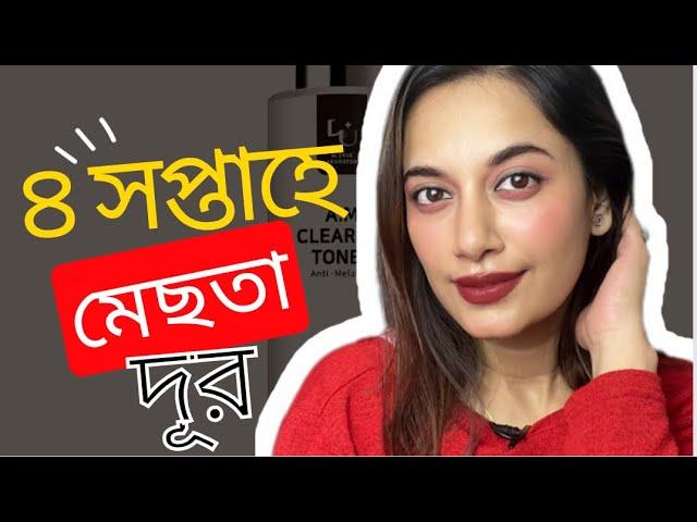 ৪ সপ্তাহে মেছতা দূর॥W Skin Laboratory Anti Melasma Series