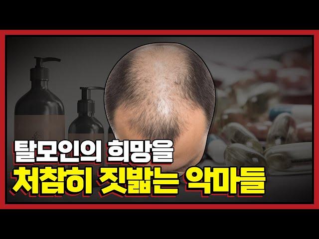 탈모 제품들은 탈모를 더 악화시키고 있다. (효과없음)