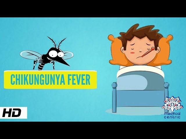 Chikungunya Fever, Causes, Signs and Symptoms,Diagnosis and Treatment.