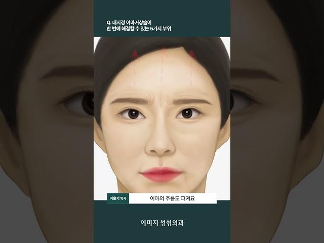 내시경 이마거상술이 한 번에 해결할 수 있는 5가지 부위