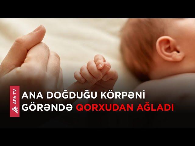 Yeni doğulan körpə nəyə görə qorxuya səbəb oldu? – APA TV