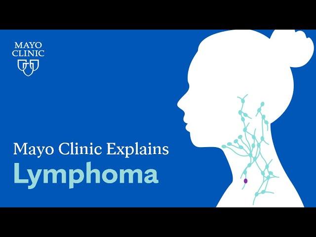 Mayo Clinic Explains Lymphoma