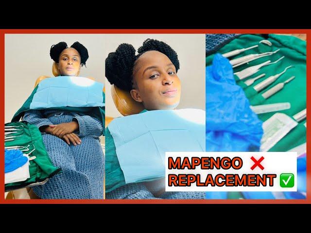 RUTH K FILLING THE TOOTH GAP SURGERY  || MAPENGO  , REPLACEMENT 