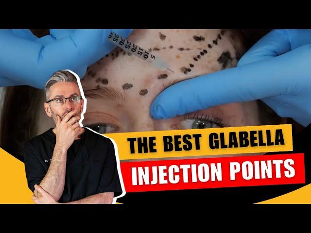 Injecting the glabella. Injection Points & Safety Advice