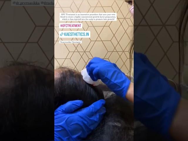 The Growth Factor Concentrate Therapy | A highly Advanced Version of The PRP treatment | GFC Therapy