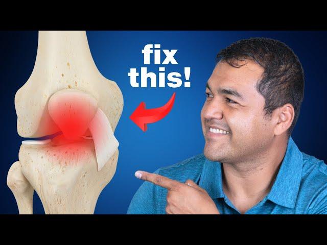 First Thing You Should Do for Bone-on-Bone Knee Arthritis