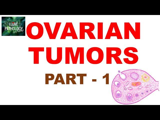 OVARIAN TUMORS -  Part 1 : Classification