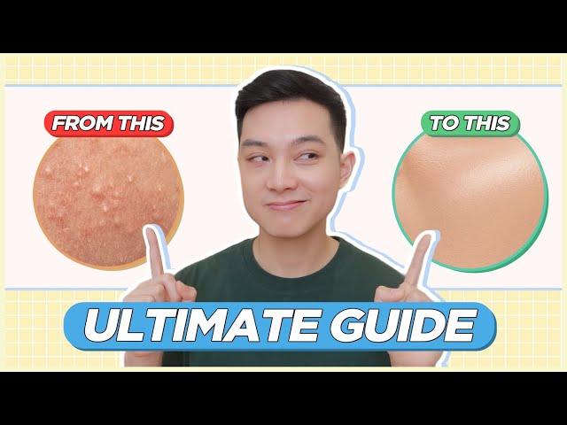 ULTIMATE GUIDE to Treat & Prevent BLACKHEADS, WHITEHEADS, TINY BUMPS for FILIPINO SKIN! | Jan Angelo