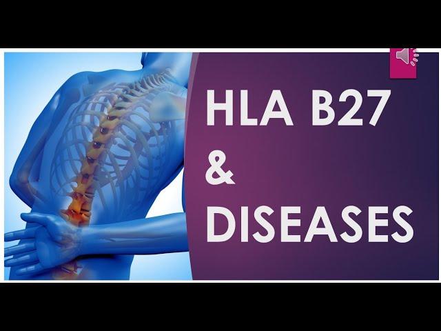 USMLE Step 1 Immunology - HLA-B27 & Associated diseases with Step 1 questions.