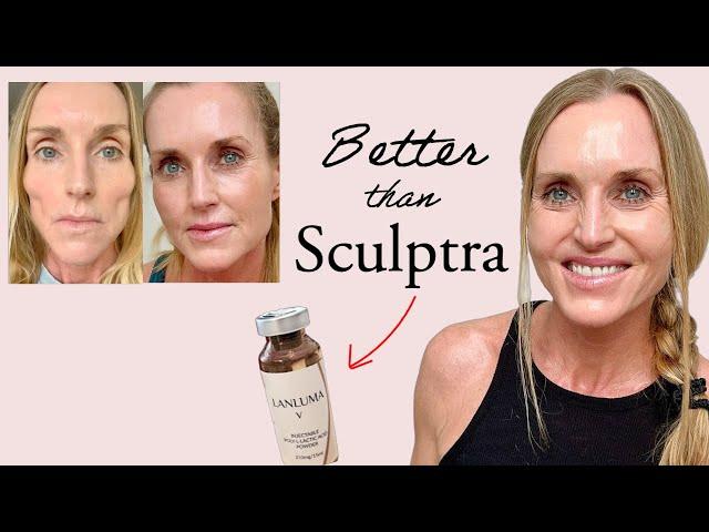 How I finally reversed my Facial Fat/Volume Loss (without Filler) |  Lanluma vs Sculptra