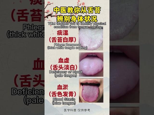 中医教你从舌苔辨别身体情况