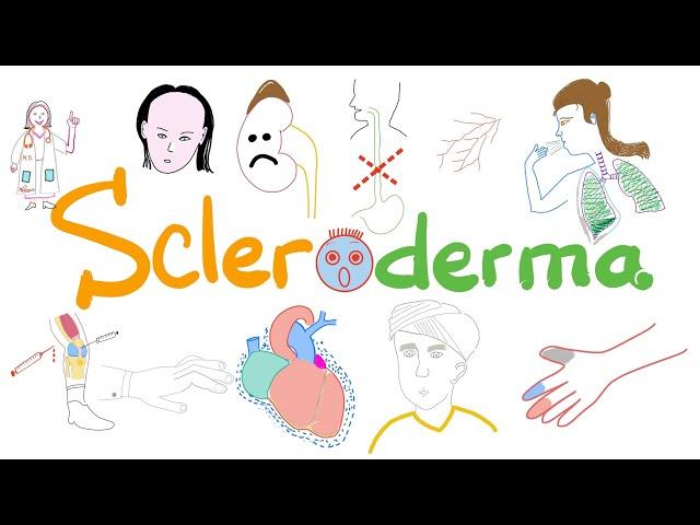 Scleroderma (Systemic Sclerosis) - Signs, Symptoms, Pathophysiology - Rheumatology