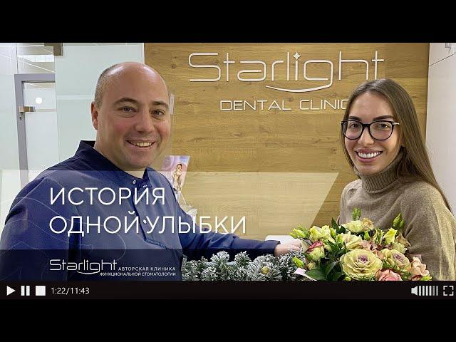 Преображение улыбки при помощи керамических виниров
