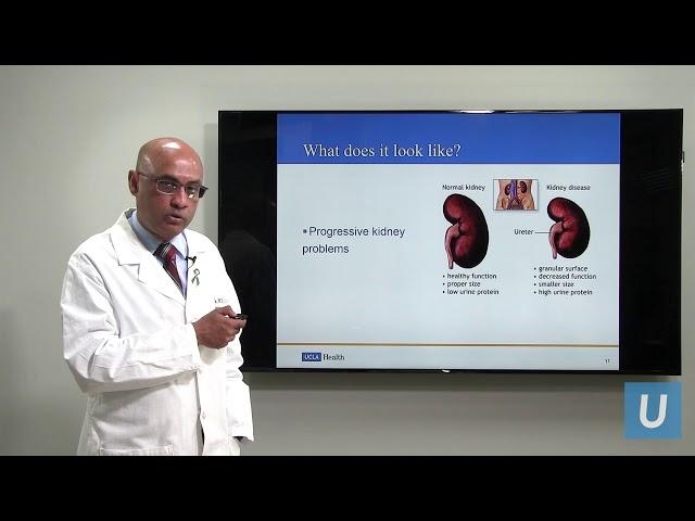 Kidney Disease: What You Should Know | Anjay Rastogi, MD | UCLAMDChat