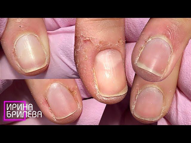 DIFFICULT manicure  SKINNED fingers  Irina Brilyova (English SUBTITLES)