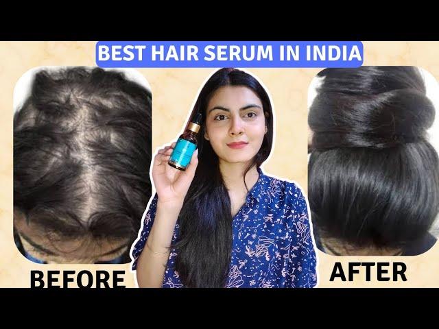 How I Regrew My Hair in just 28 days | Pilgrim Hair Growth Serum #hairtransformation #hairserum