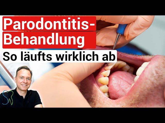 So läuft eine Parodontitisbehandlung wirklich ab️