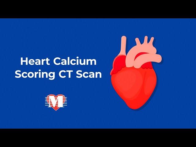 Heart Calcium Scoring CT Scan – Memorial Cardiac and Vascular Institute