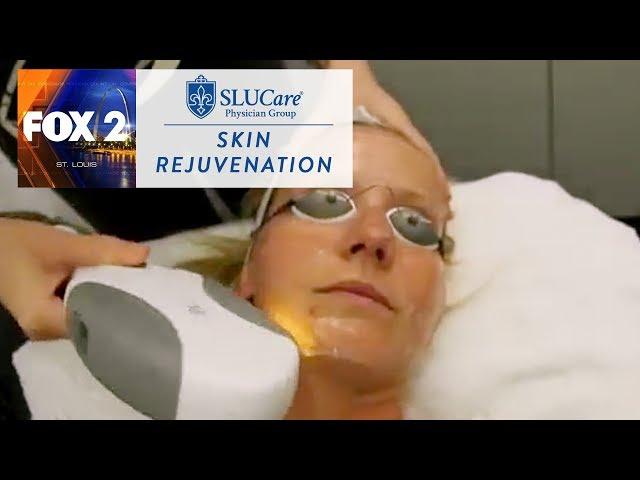 Skin Rejuvenation - SLUCare Health Watch