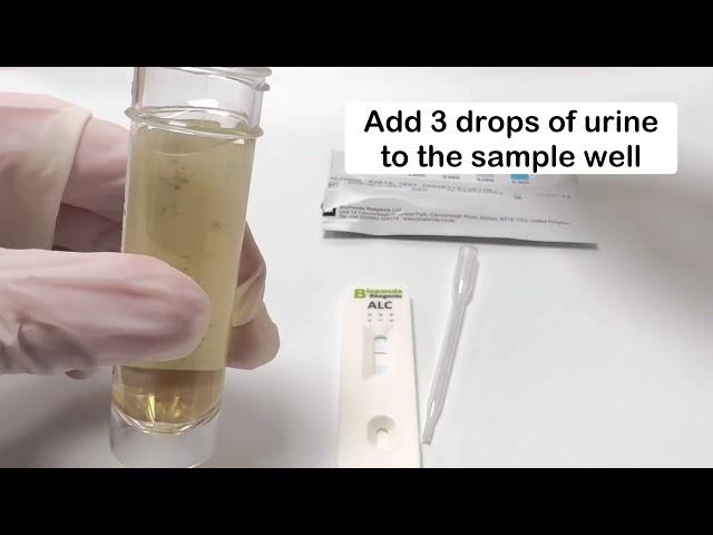 Alcohol Rapid Test Cassette Urine
