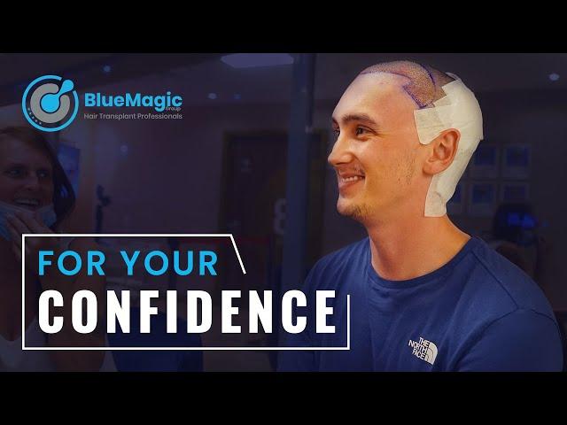 Adam traveled from UK to Istanbul for his BEST hair transplant option | BlueMagic Group Reviews