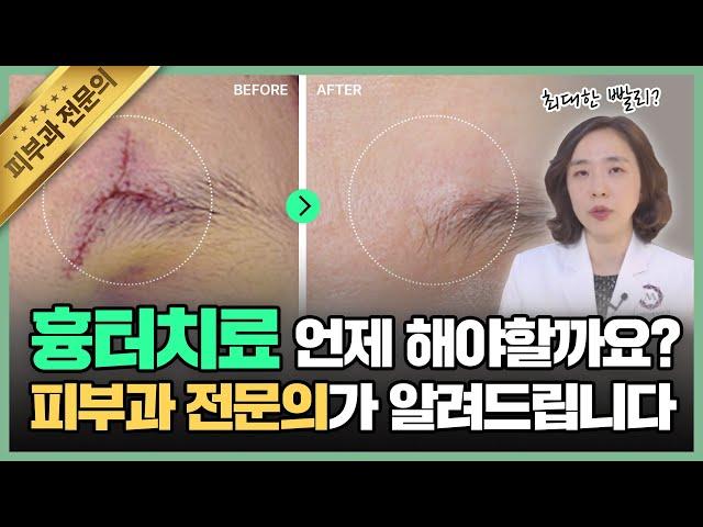 흉터가 남지 않게 하려면? '이때'가 치료 골든타임!