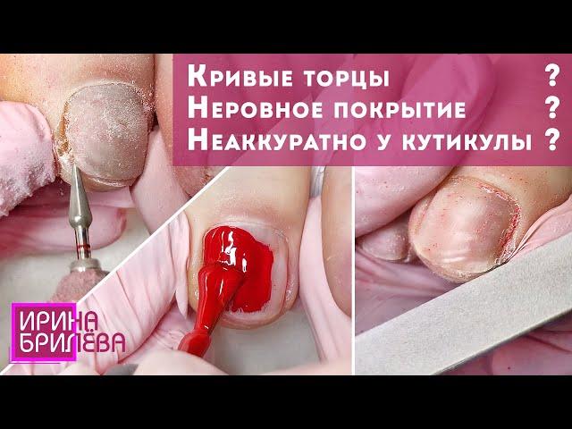 Педикюр  Кривые торцы  Неровное покрытие  Неаккуратно у кутикулы Педикюр пальчики