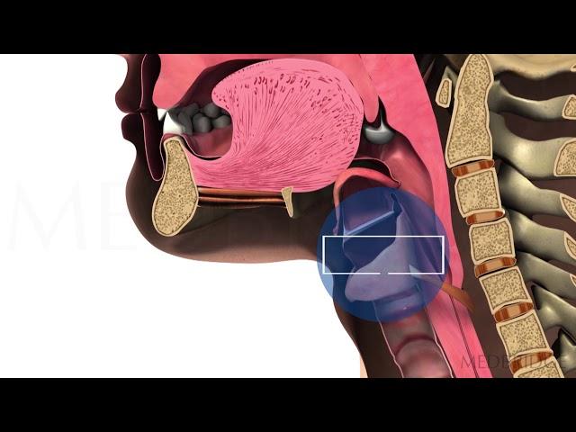 Functioning of the Upper Esophageal Sphincter - Michael Groher | MedBridge
