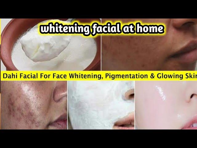 Dahi Facial For Glowing Skin | That Remove Pigmentation & Dark Spots - Lightnes Dull Dark Skin