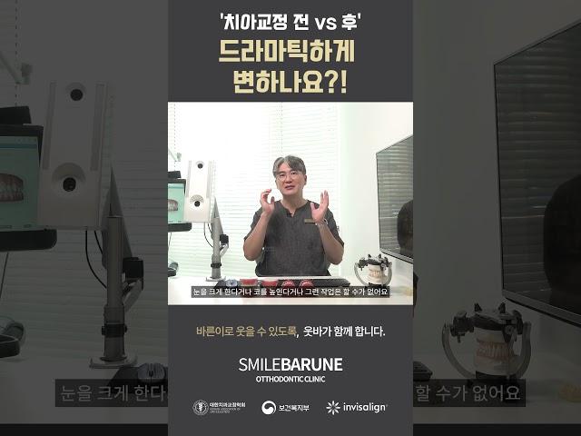 치아교정 전, 후 드라마틱하게 변할까요?[이수역, 웃는바른이교정치과] #이수역치과 #사당역치과 #방배동치과 #동작구치과 #이수역교정치과 #이수역치아교정