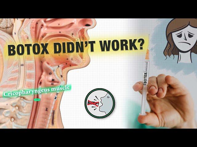 What if Botox Doesn’t Work for My R-CPD? | High Quality Injections