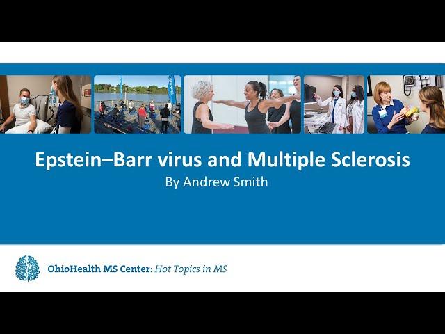 Epstein Barr Virus and MS