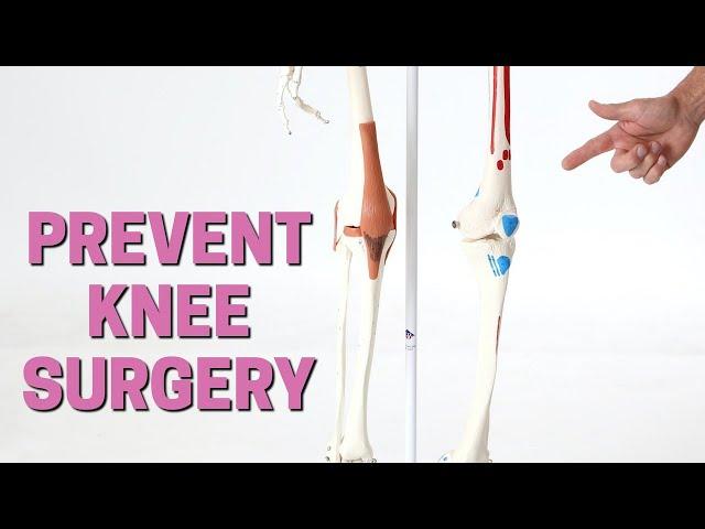 The 3 Things You Should Try BEFORE Knee Surgery or Replacement + Giveaway