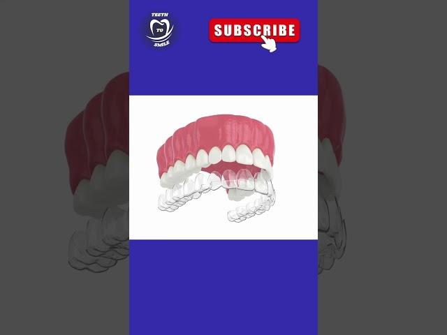 INVISIBLE ALIGNERS #dentist #shorts #short #shortvideo #shortsvideo #dentistry #viral #video #dental