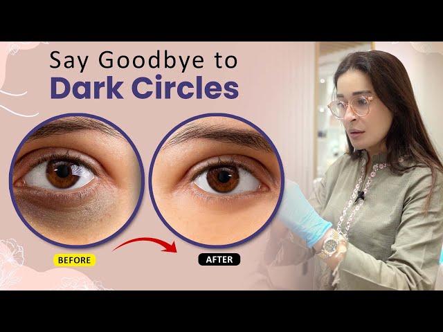 Dr  Shaista Lodhi Reveals the Shocking Truth About Dark Circles! #DarkCircles