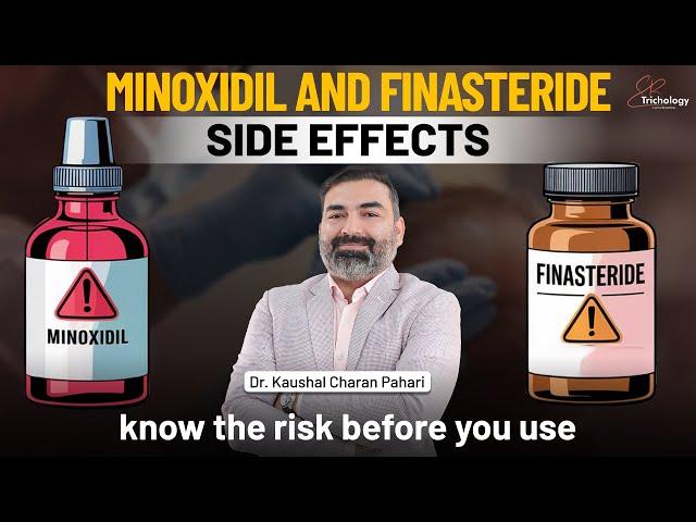 Minoxidil and Finasteride Side Effects | The Truth About Hair Loss Treatment