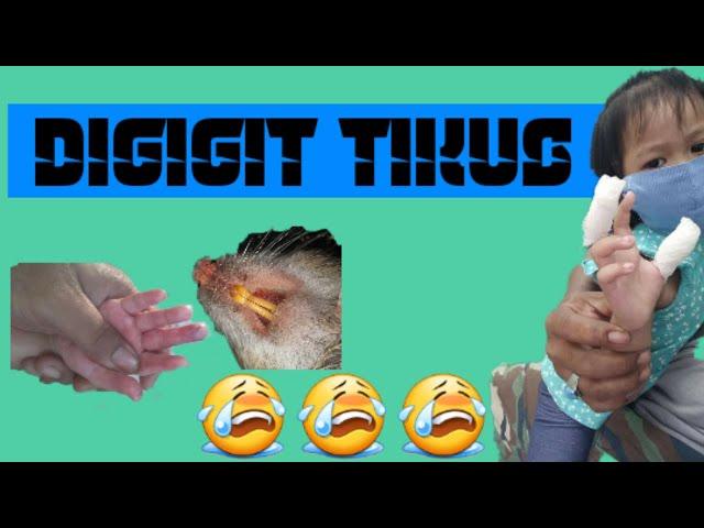 DIGIGIT TIKUS KANAK-KANAK 3 TAHUN