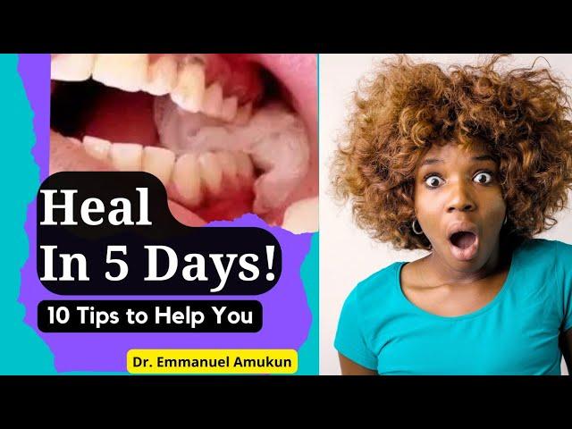 What to do after tooth extraction(Tooth pulled out) | Important instructions for speedy recovery!